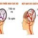 Phục hồi chức năng sau đột quỵ 3 phuc-hoi-chuc-nang-sau-dot-quy