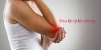 dau-khop-khuyu-tay